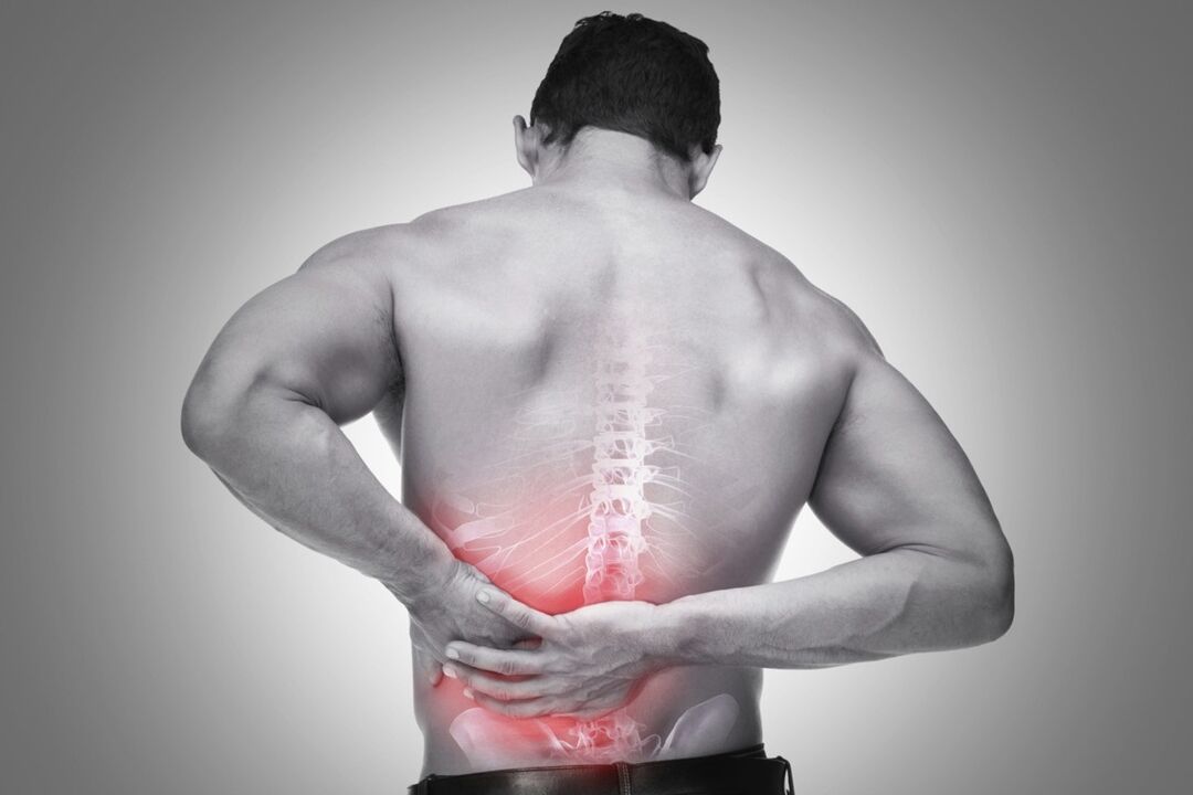 Rückenschmerzen im Lendenwirbelbereich