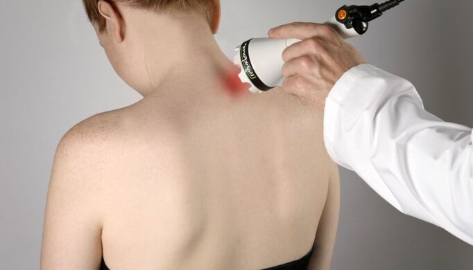 Lasertherapie bei zervikaler Osteochondrose